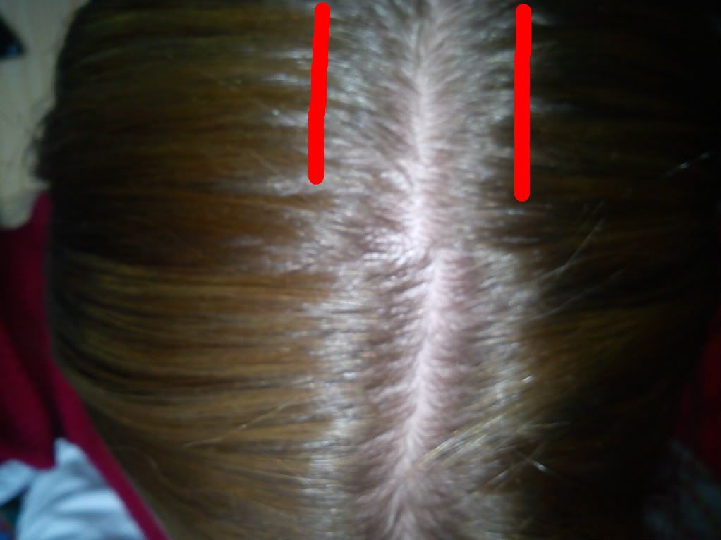 Castor Oil Hair Growth